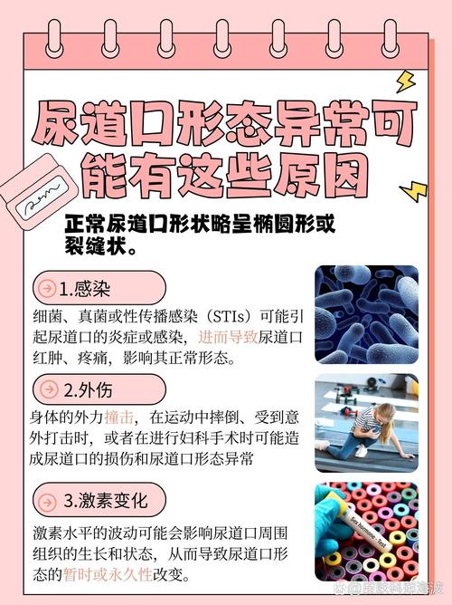 上面一边摸下面一边亲的相关介绍
